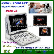 Z6 Mindray Самый дешевый CW функция цветной допплер ультразвуковой станок / ноутбук цветной допплер ультразвук